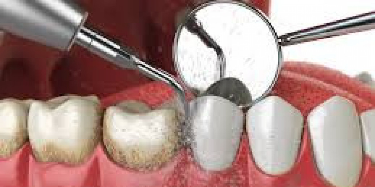 Why Regular Dental Cleaning Is Essential for a Healthy Smile