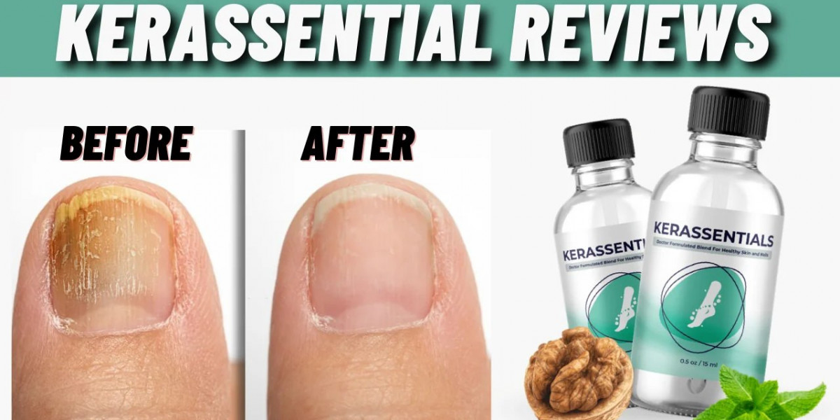 Kerassentials Review: Scam or Legit in 2025?