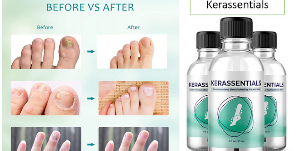 Kerassentials Toenail Fungus Oil Review – What to Know Before Use!