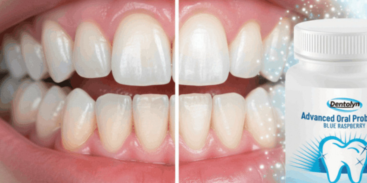 Dentolyn USA, CA, AU, NZ, UK Review: The Ultimate Natural Solution for Bad Breath